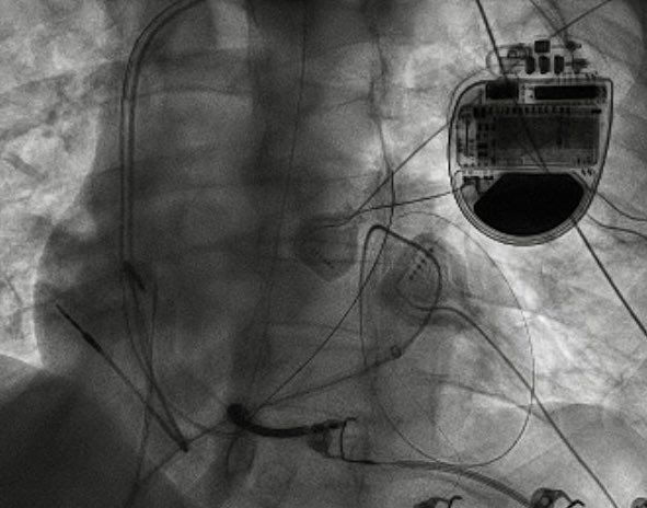 Virtua Heart Rhythm Specialists tweet media