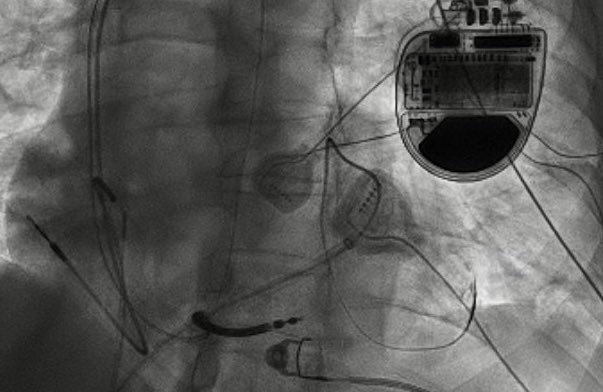 Virtua Heart Rhythm Specialists tweet media