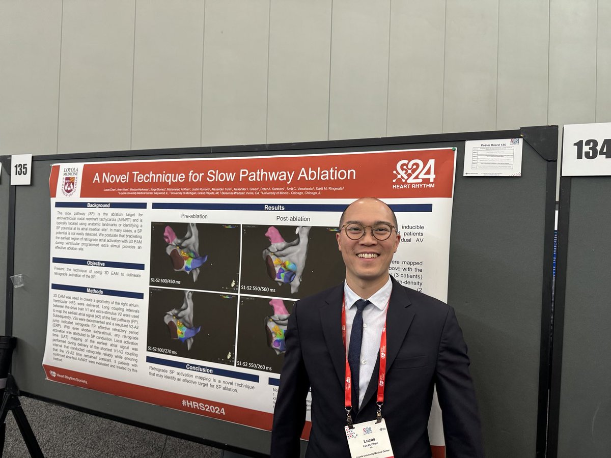 Smit Vasaiwala, MD (@svasaiw) on Twitter photo Future EP fellow Lucas Chan shares a novel way to identify slow pathway insertion at #HRS2024 ā¦<a href="/LUcardsfellows/">Loyola Cardiology Fellows</a>ā© ā¦<a href="/LoyolaMedMD/">Loyola Medicine MD</a>ā© ā¦<a href="/SukitRingwalaMD/">Sukit Ringwala</a>ā© ā¦<a href="/UICDom/">University of Illinois Department of Medicine</a>ā© Future EP fellow Lucas Chan shares a novel way to identify slow pathway insertion at #HRS2024 ā¦<a href="/LUcardsfellows/">Loyola Cardiology Fellows</a>ā© ā¦<a href="/LoyolaMedMD/">Loyola Medicine MD</a>ā© ā¦<a href="/SukitRingwalaMD/">Sukit Ringwala</a>ā© ā¦<a href="/UICDom/">University of Illinois Department of Medicine</a>ā©