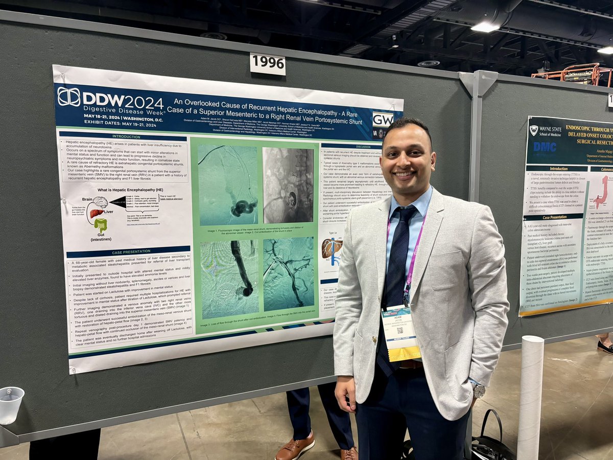 Complex encephalopathy case.. great job team <a href="/AdamMJacob/">Adam M. Jacob, DO</a> <a href="/DrJessicaDavis/">Jessica Davis</a> and co-authors! <a href="/GW_Gastro/">GW Gastroenterology Fellowship</a> <a href="/DCVAMC/">WashingtonDCVAMC</a> #DDW2024