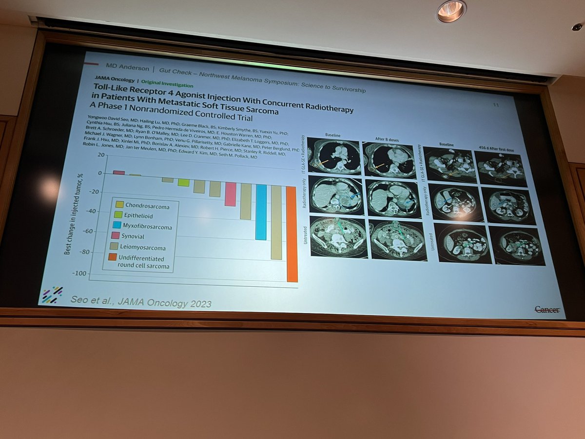 @DavidSeoMD @MDAndersonNews presents keynote talk at NW Melanoma Pt/Caregiver Symposium @fredhutch @CureMelanoma on #microbiome work and immunotherapy response in cancer treatment. Inspiring and highly informative!