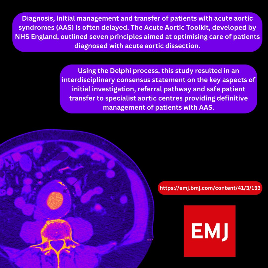 #OriginalResearch #March2024 Consensus statement on the interhospital transfer of patients with acute aortic syndrome: TRAVERSING Delphi study emj.bmj.com/content/41/3/1… @rebellvascular @drsgrier @Icarus1054 @RCollEM