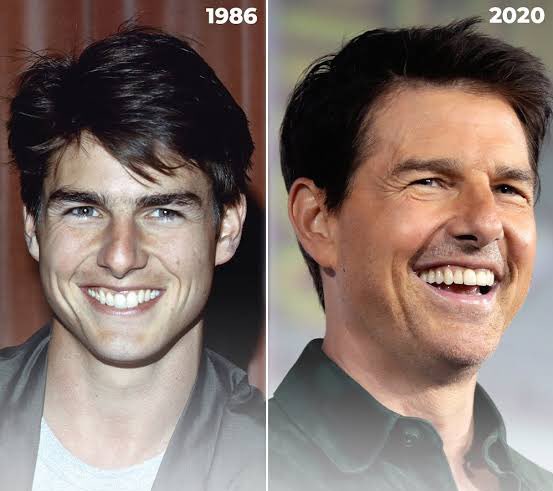 Tom Cruise, röpartajlarından birinde şöyle anlatıyor; ‘Uzun yıllardır kolajen kullanıyorum.Doktorum kolajeni diyetime eklememi söyledi ve yaptım. Birkaç ay içinde antremanlarımı, ruh halimi, dayanaklığımı,saçlarımı,eklemlerimi ve cildimi nasıl değiştirdiğine inanmadım.En az 10