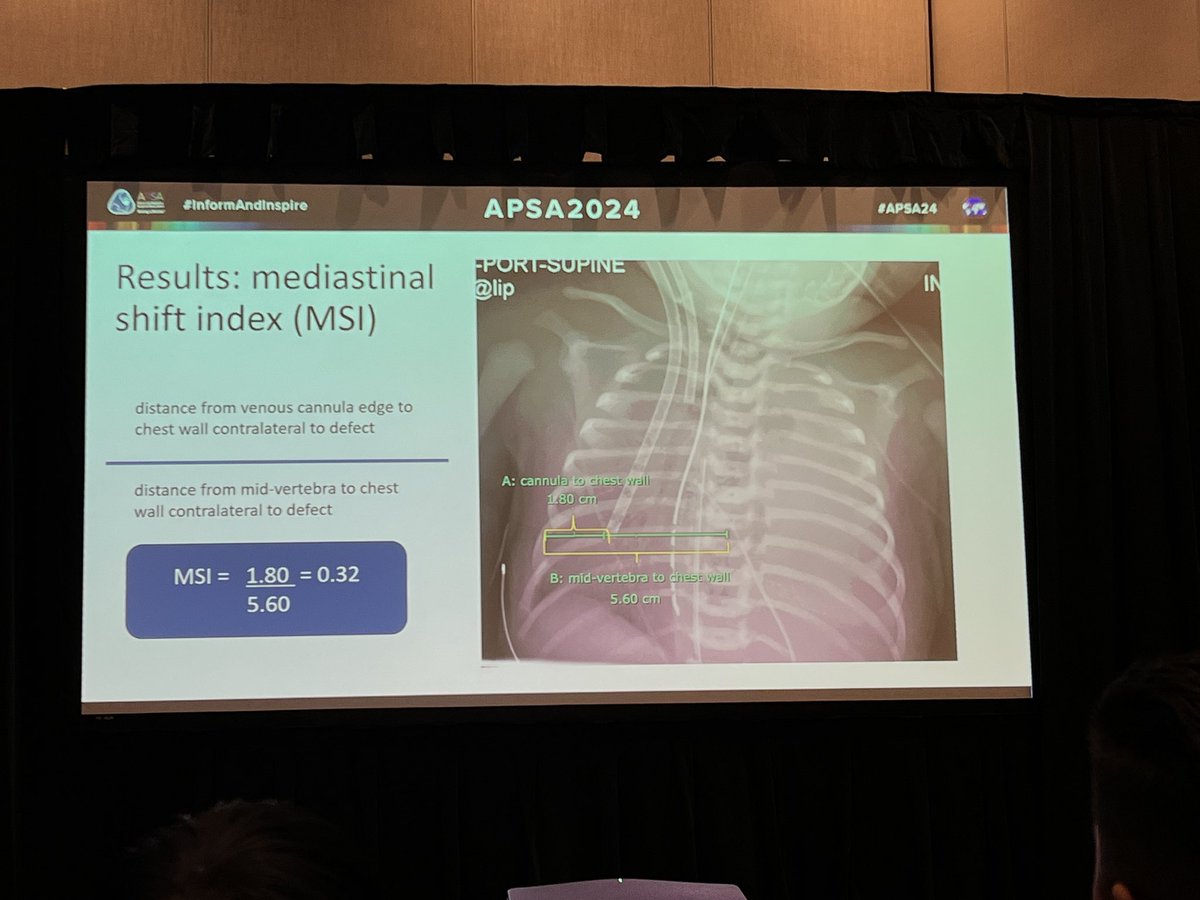 Rachael Sundland (@rsundland) on Twitter photo Can we better understand how the effect of mediastinal shift effects survival of CDH patients on ECMO and use this as a prognostic tool? #APSA24 <a href="/APSASurgeons/">APSA Surgeons</a> Can we better understand how the effect of mediastinal shift effects survival of CDH patients on ECMO and use this as a prognostic tool? #APSA24 <a href="/APSASurgeons/">APSA Surgeons</a>