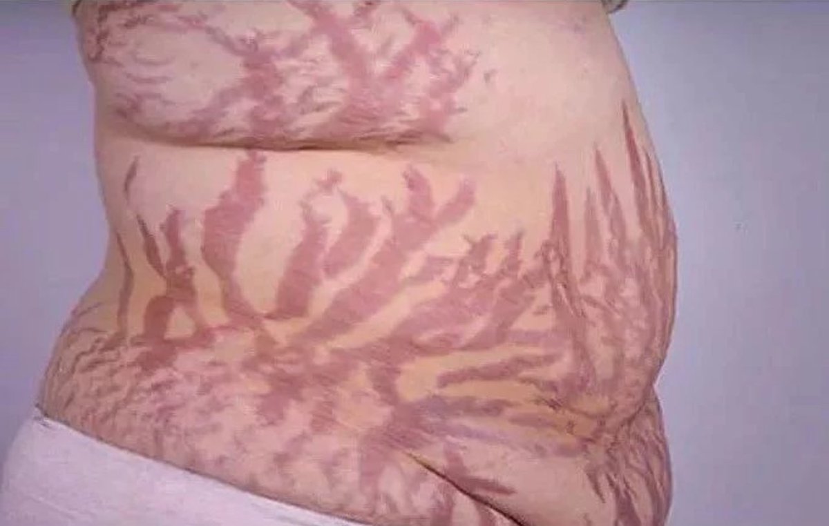 Keith Siau tweet media