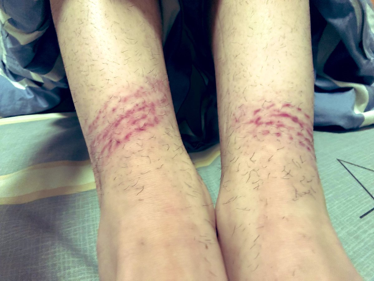 自缚需谨慎，自缚需谨慎，自缚需谨慎。这次真被吓到了😭😭。
以后还是只找人绑绑好了，自己就简单点玩。🥹