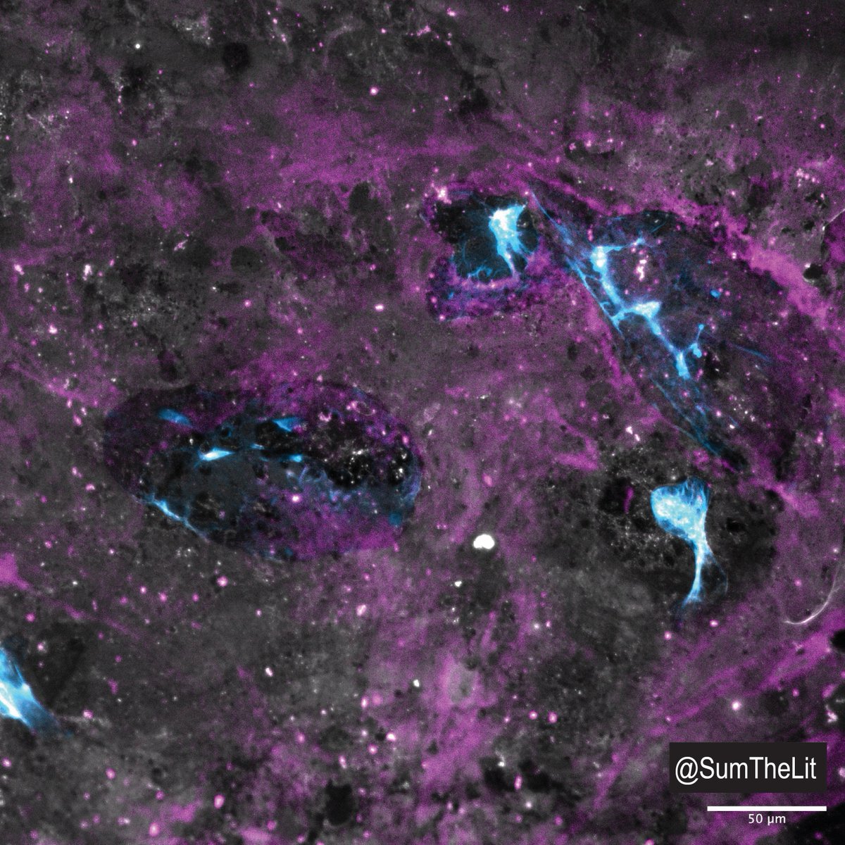 SumTheLit's tweet photo. What do these images make you think of? 🌌🌃🔭🌉

They're actually microscopic images at 20x magnification from one of my cell experiments this week. 🧪🧫🔬💻 

Which staining looks better to you?

#microscopy #fluorescentmicroscopy #microscopymonday https://t.co/LkXJvsRWSI