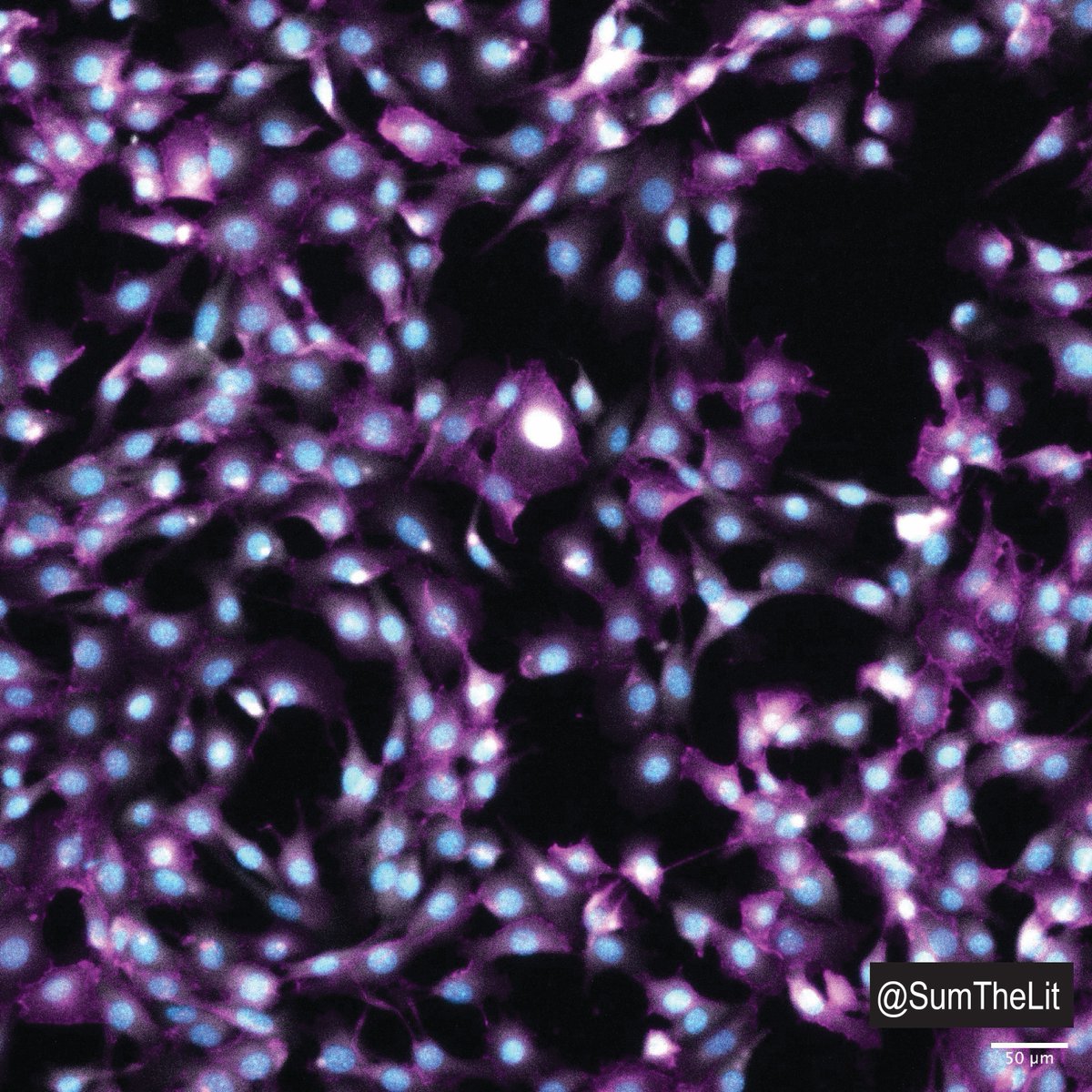 SumTheLit's tweet photo. What do these images make you think of? 🌌🌃🔭🌉

They're actually microscopic images at 20x magnification from one of my cell experiments this week. 🧪🧫🔬💻 

Which staining looks better to you?

#microscopy #fluorescentmicroscopy #microscopymonday https://t.co/LkXJvsRWSI