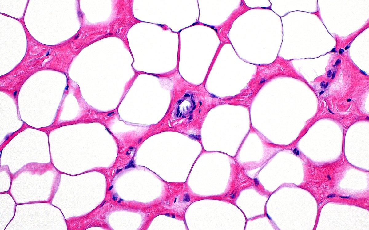 Fibrofatty Breast Tissue ~ #PathArt #Histology #BreastPath