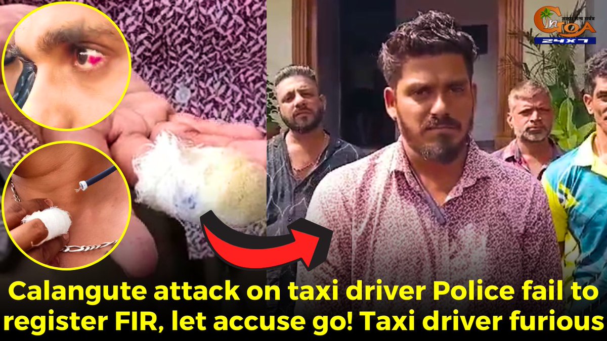 Calangute #attack on taxi driver. Police fail to register FIR, let accuse go! Taxi driver furious WATCH : youtu.be/sdqcyH0JzBw #Goa #GoaNews #police #fail #FIR #accuse