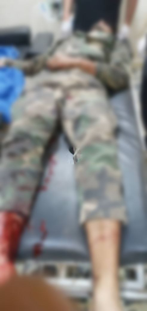 #SonDakika 

''Bölgeye Yönelik İşgal Saldırıları Devam Ediyor''

🔷İşgalci Türk ordusu ve çeteleri, Şehba Barajı çevresini ağır silahlarla hedef aldı.

🔹Saldırıda Suriye rejim güçlerinden 36 yaşındaki 'Beşar Cabur' isimli kişi yaralandı.

🌐t.me/rojava_gundemi