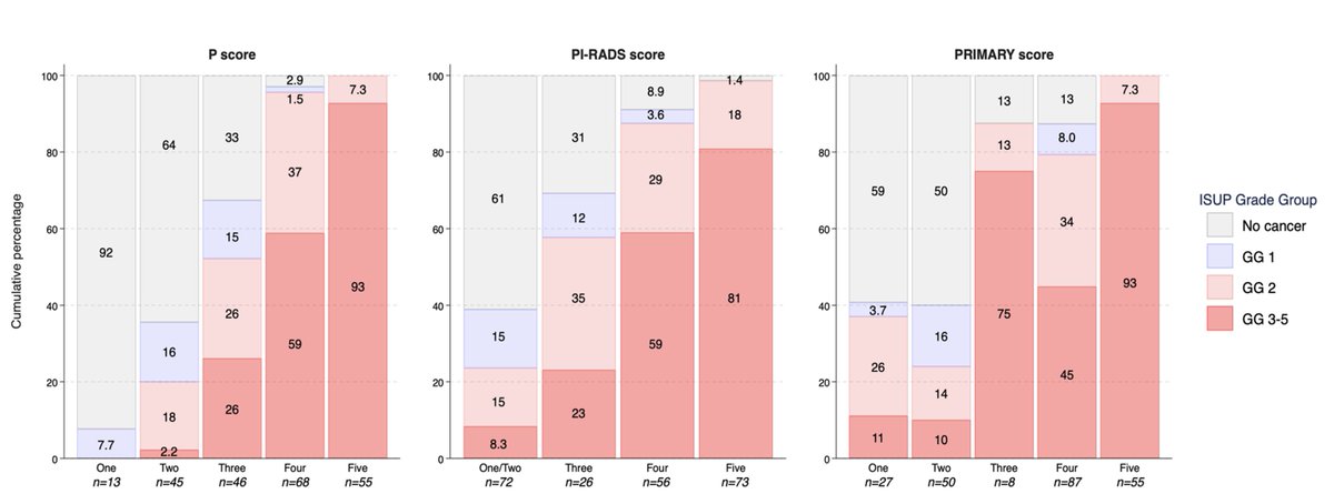 PSMA PRIMARY score + MRI PI-RADS (P score) has higher accuracy than either alone for prostate cancer diagnosis. 99% sensitivity, 98% NPV for ISUP 3 malignancy. PMID: 38758680. @JUrology @SVHSydney @pros_tic