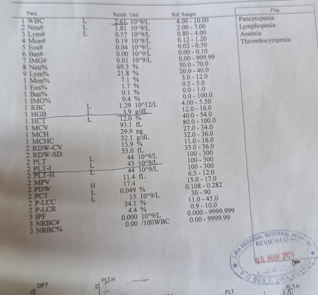 🏥 Lira medical camp case! 51 M on hemodialysis with recurrent anemia. 👉 What is the lowest HB u have managed? 👉 How did he manage to walk in to the clinic with no support? 👉 What is your diagnosis? 👉 We have no other tests, what do we do? @DrOribaDan @graekan @TSM_Humanist