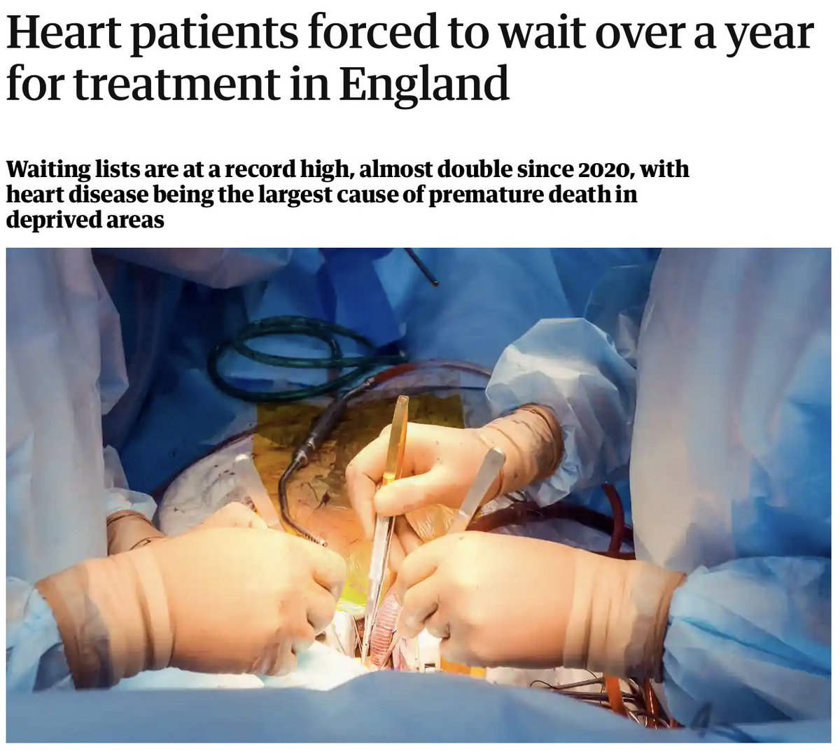 There are 414,596 people waiting for heart procedures - double the number in 2020. Of these, 10,893 have been waiting over a year. 4 years ago, that figure was just 53. This isn't inevitable, unavoidable or because the NHS is 'failing.' It is a shameful political choice.