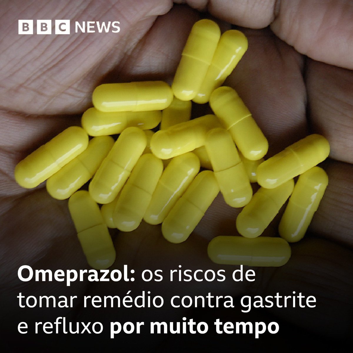 64,9 milhões de unidades de omeprazol foram consumidas no Brasil apenas em 2022, calcula a Anvisa 💊 

Mas o que muita gente não sabe é que esse remédio só deve ser usado por um prazo bem curto, de no máximo dois ou três meses: bbc.in/4aonupJ

#ArquivoBBC