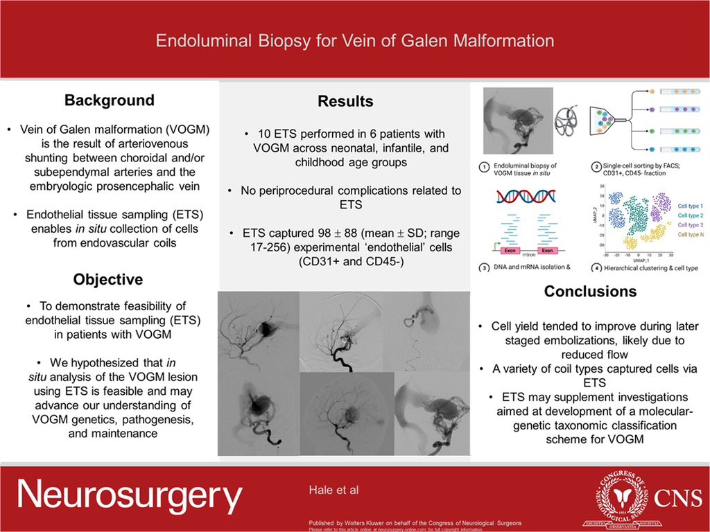 Endoluminal Biopsy for Vein of Galen Malformation journals.lww.com/neurosurgery/f…