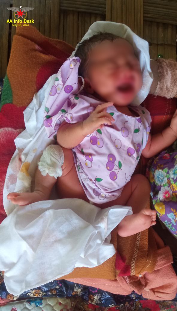 On 15 May 2024, the terrorist Military Council bombed the WaeGyiDauk Hospital in Kyauktaw Township, Rakhine State. Resulted in a compete destruction of the hospital, the tragic deaths of some civilians and 20 civilians injured.

go.nugmyanmar.org/4e4e98e9

#WhatsHappeningInMyanmar