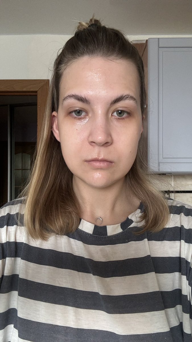 prshtk_'s tweet photo. Короче у меня целая коллекция отеков по утрам https://t.co/1CGeKn38x2