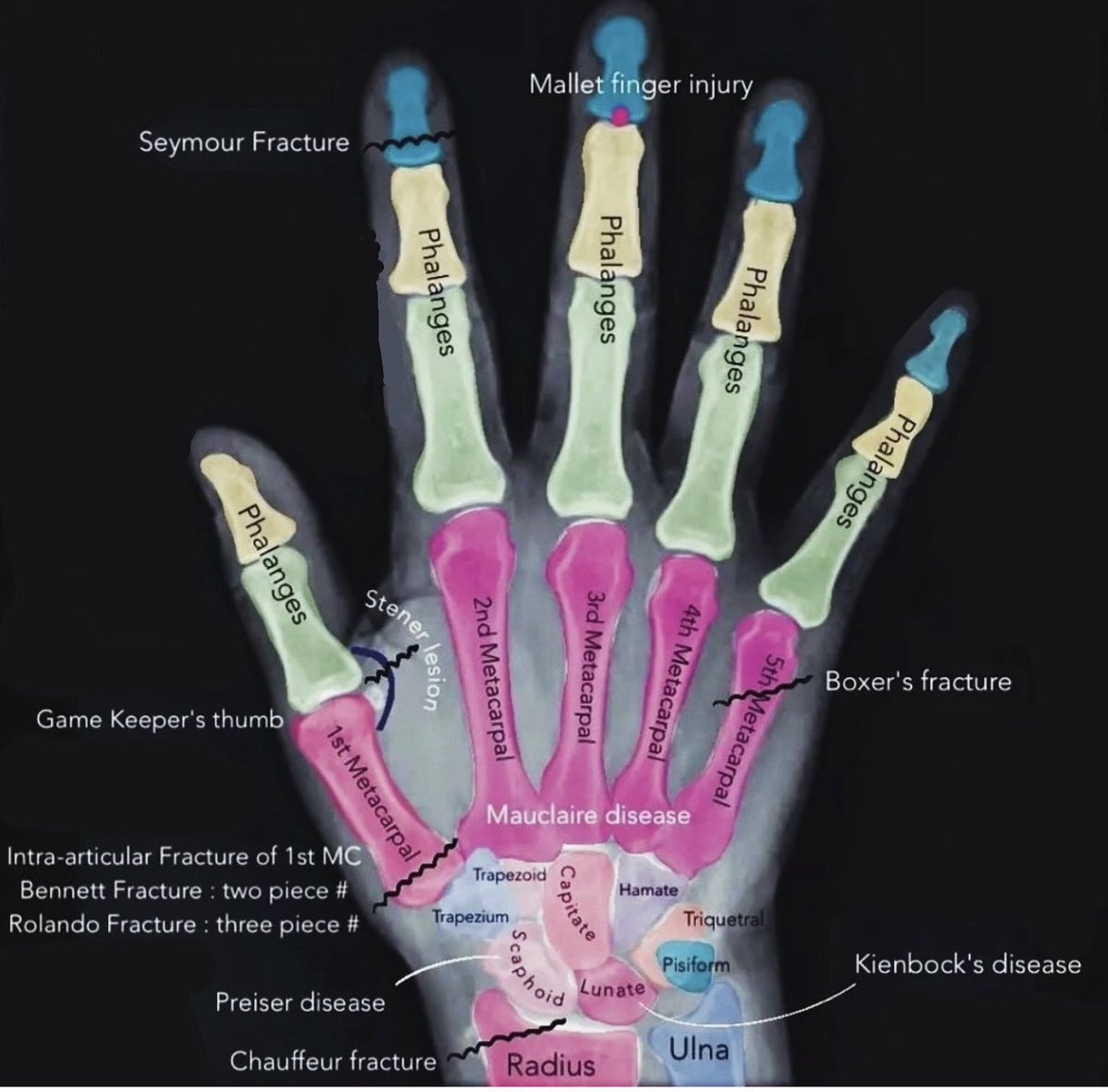 Hand pathology and injuries from traumaorthopaedics
