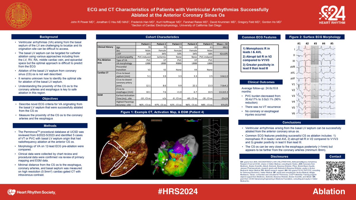 JohnPowerMD's tweet image. Learned a lot at @HRS2024 sharing @UCSDCardiology experience identifying and treating crux VTs with ablation at the CS os @GordonHo_EP