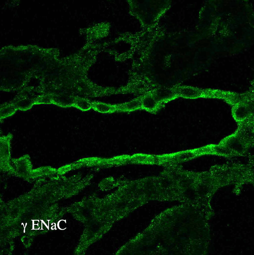 Product Citation: StressMarq's Anti-ENaC gamma Antibody (SPC-405) was used to investigate the effect of SARS-CoV-2 S protein on proteolytic cleavage of epithelial Na+ channel ENaC. 

SPC-405 ⭐ bit.ly/4dpj84e | Paper 🌙 bit.ly/3ULr5K8
