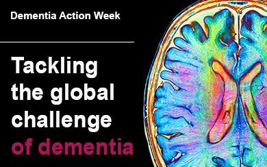 This #DementiaActionWeek, we have been shining a light on how at @ucl we are tackling the global challenge of #dementia through our world-leading research and expertise. #DementiaActionWeek #DAW2024 #UCLDementia Find out more about our work ➡️ bit.ly/3V4ALiL