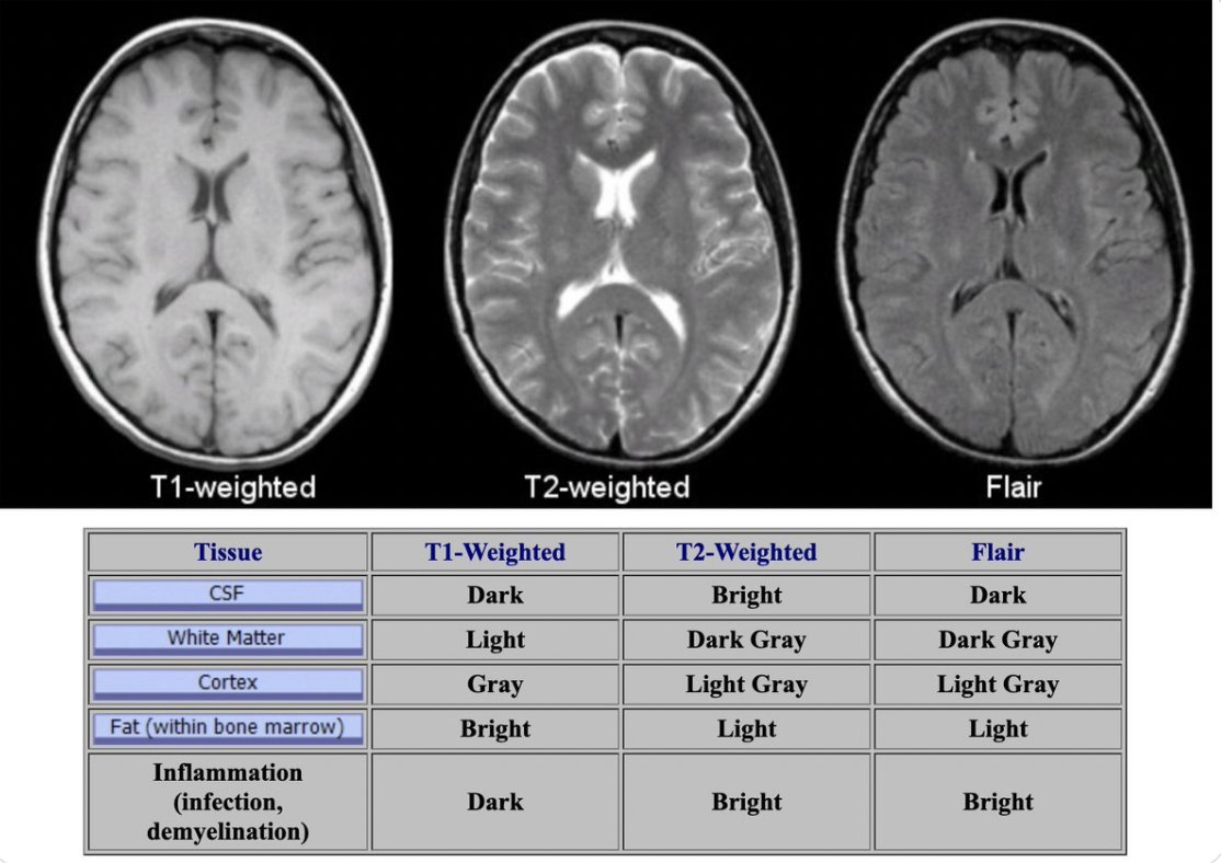 MRI Basics For those like me who always struggle to remember T1 vs T2 vs FLAIR this article is useful. It also explains the physics of MRI which is cool. case.edu/med/neurology/…