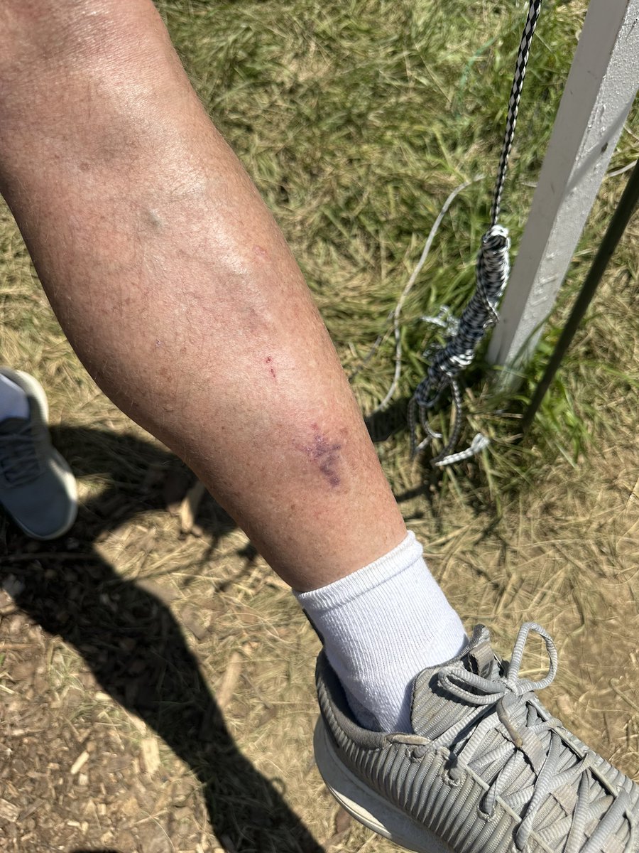 Kim hit a Louisville Golfer Volunteer on Hole 5 that led to a Par. He said it “hurt like hell.” It certainly looks like it. #PGAChampionship