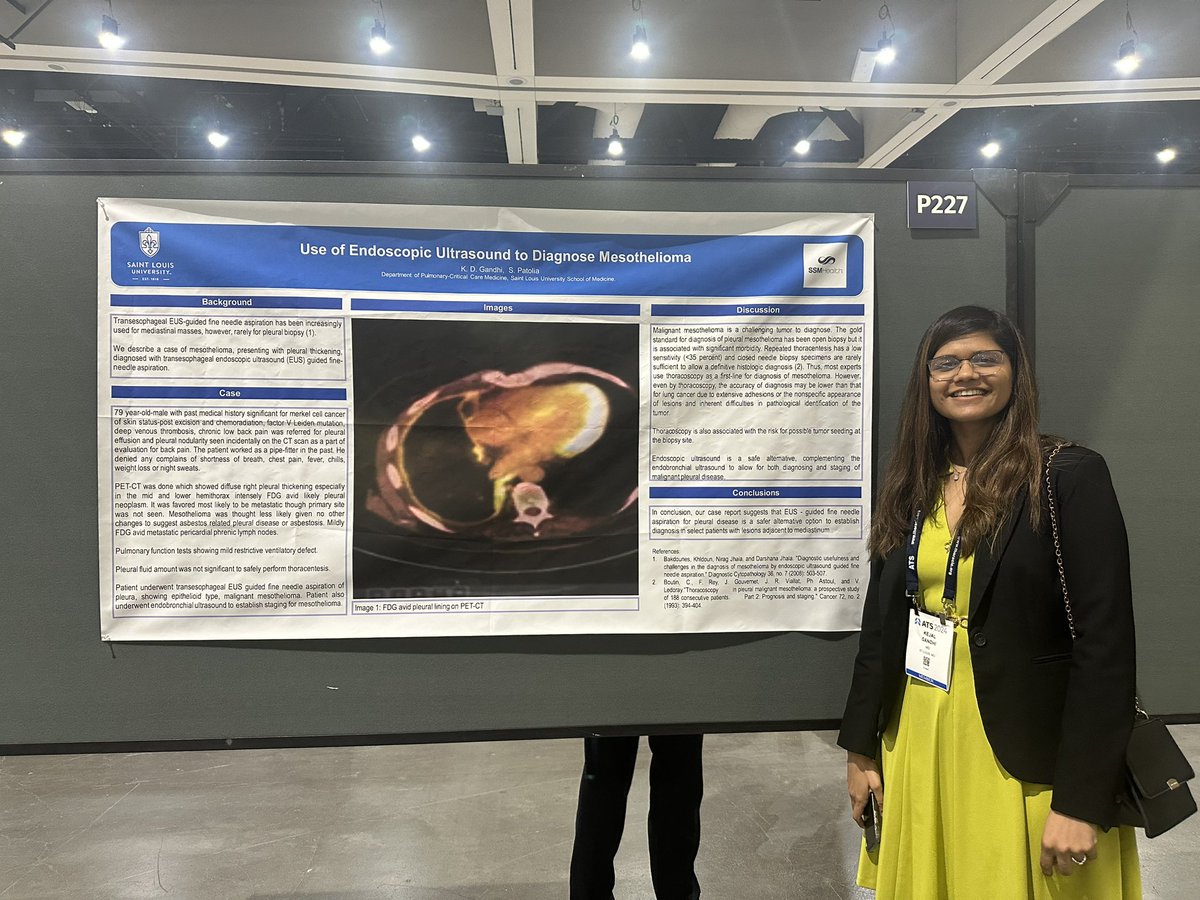 SLU Pulmonary and Critical Care Fellowship (@slupccm) on Twitter photo Second year fellow <a href="/GandhiKejal/">Kejal Gandhi</a> about diagnosing mesothelioma. Thank you Dr Patolia for mentoring. #ATS2024 Second year fellow <a href="/GandhiKejal/">Kejal Gandhi</a> about diagnosing mesothelioma. Thank you Dr Patolia for mentoring. #ATS2024