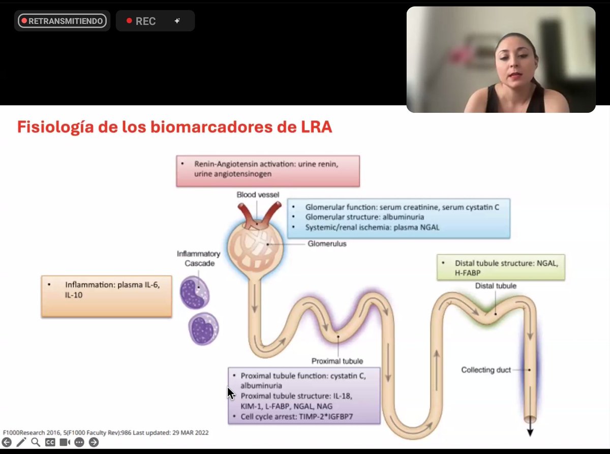 AvelRomanNeph's tweet image. Que biomarcadores tenemos para dx #LRA de acuerdo al segmento en la nefrona? 

@DraMarili @nefrocmnlr