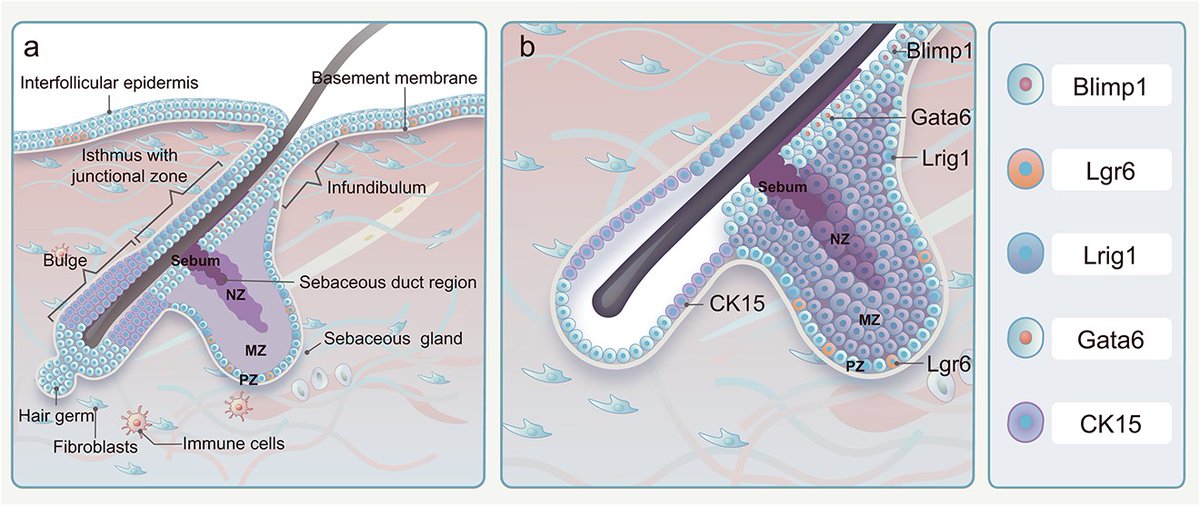 The authors provide an overview of recent advancements in 🧫 sebaceous glands (SG) #organoid engineering. 💡 They highlight promising strategies for SG organoid functionalization! @burns_trauma | 🔗 bit.ly/4aeM3Fw