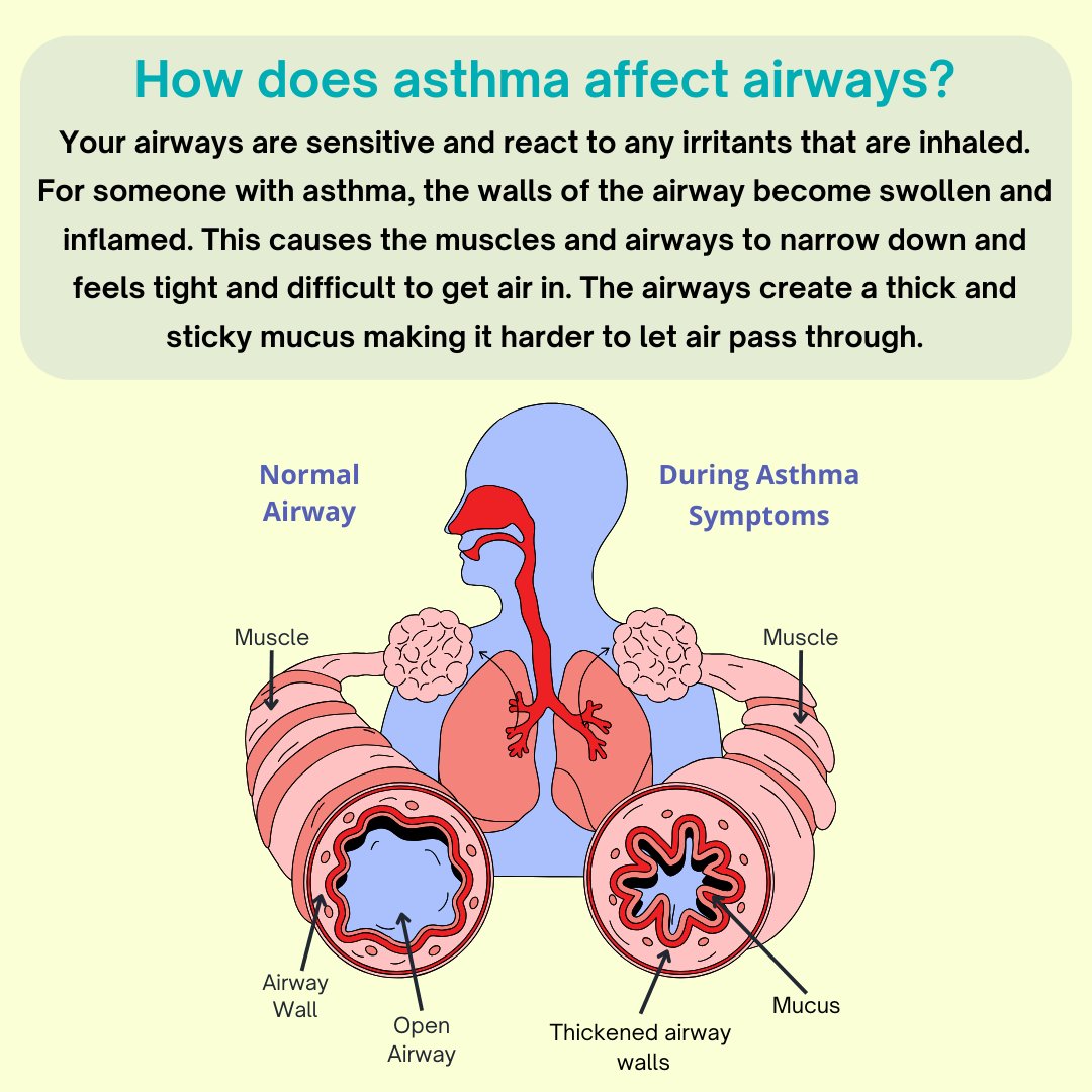 An estimated 25.2 million people, including 4.2 million children, have asthma. More than 10.3 million people with asthma, including nearly 1.8 million children, report having had one or more asthma attacks in 2020. epa.gov/sites/default/… #AsthmaAndYourHealth #AQAW2024
