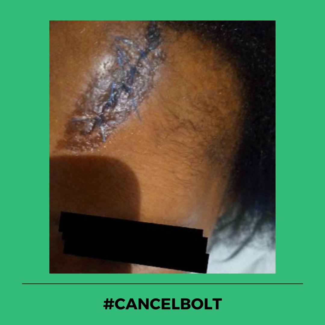 On 6 May 2024, two women, aged 38 and 23, booked a Bolt ride to Lenasia, Johannesburg. Instead of the driver dropping the two women at their location, he drove somewhere else. He then allegedly beat them up and stabbed both of them in their faces multiple times. The driver robbed