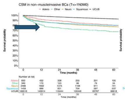 Very high-risk #NMIBC with variant histology. Presentation by @uromc @OUUrology. #AUA24 written coverage by @zklaassen_md @UofT > bit.ly/4dtNwe0 @AmerUrological