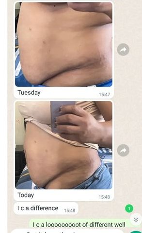 #Amakhosi4Life
Belly fat juice