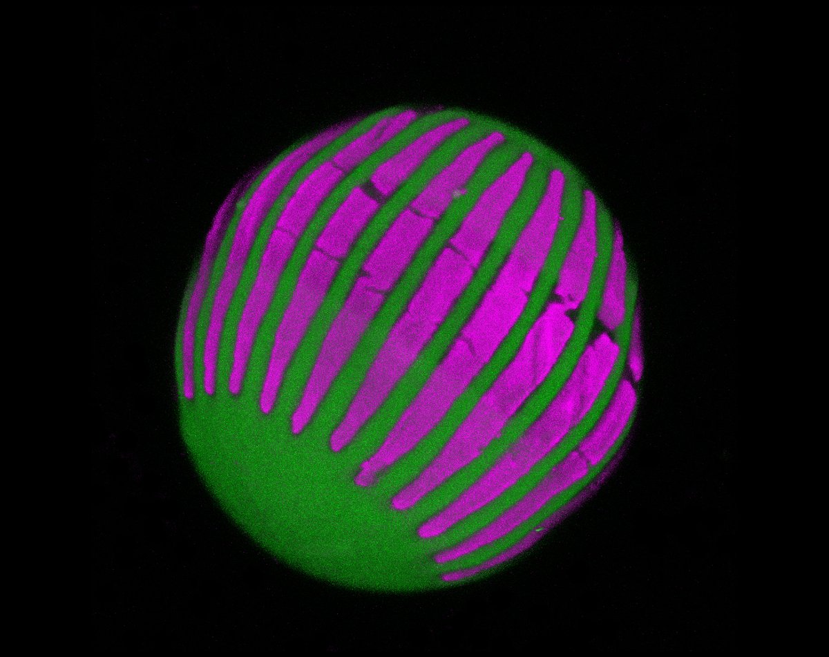 Nat Prunet ๐ธ๐ฌ๐ณ๏ธโ๐ (@nat_prunet) on Twitter photo Orthogonal (right) vs 45ยฐ perspective projection (left) of a #confocal z-stack of a #pollen grain, viewed with <a href="/ImarisSoftware/">Imaris 3D/4D Imaging</a> 3D viewer - I love how the perspective adds to the 3D perception ๐
#microscopy #bioart #sciart #botany #plantscience #fluorescence #fluorescent #plants Orthogonal (right) vs 45ยฐ perspective projection (left) of a #confocal z-stack of a #pollen grain, viewed with <a href="/ImarisSoftware/">Imaris 3D/4D Imaging</a> 3D viewer - I love how the perspective adds to the 3D perception ๐
#microscopy #bioart #sciart #botany #plantscience #fluorescence #fluorescent #plants