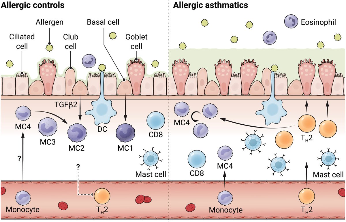 A 2023 paper described how tissue and myeloid cells react differently to allergens in the lungs of people with #asthma versus the lungs of those without asthma. Read more on #WorldAsthmaDay: scim.ag/6Sl; scim.ag/6Sm