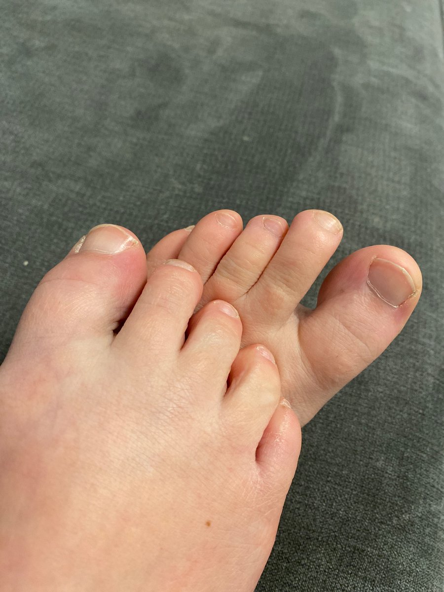 SophiaSmith159x's tweet photo. Who wants to pay for my next pedicure? £85 required. 
#pedicureneeded #payformypedicure #feet #needatreat #needapedicure https://t.co/9vwaONbrCK