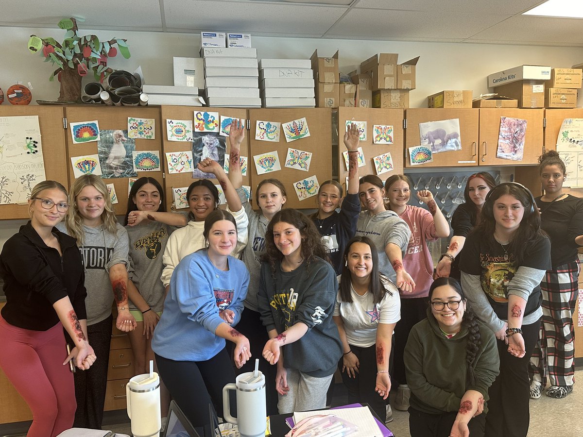 HBS Burns 🔥🔥🔥