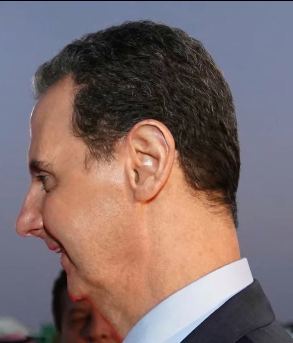 Bashar looks like a mental asylum patient
