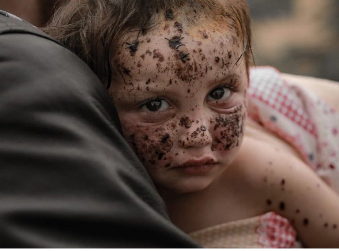 Kana buladılar masum çocuklarımızın temiz yüzlerini... yaşamanın azaba dönüştüğü buhran dolu zamanlardayız..
Bu zulmün ahı yeter bize!