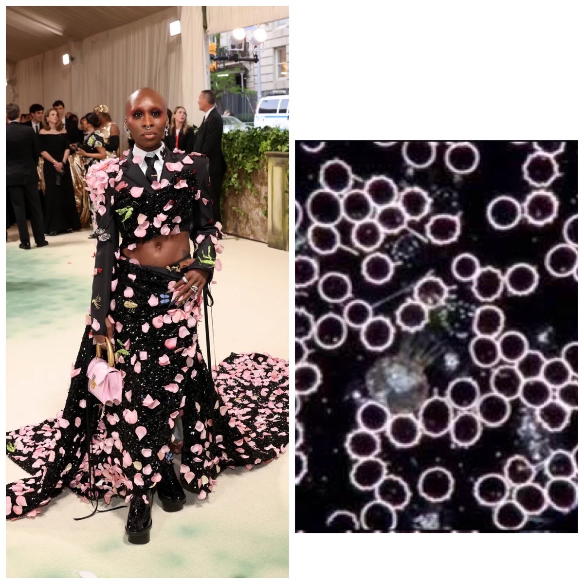 Back by popular demand! The #MetGala as things seen in science… First up, Cynthia Erivo as dark field microscopy blood cells: