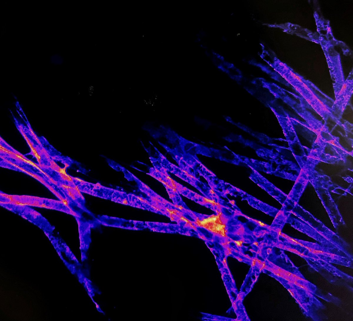 Yesterday was a good imaging day 🔬
Myelin on artificial axons (microfibers) 
#confocal #myelin #myelinworld #babysteps #microscopy #neuroscience #graduatestudent