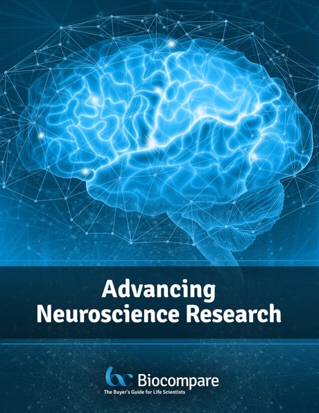 StressMarq was recently featured in a new eBook! Check it out to learn more about the sonication of pre-formed fibrils in neurodegenerative disease research. bit.ly/3GLtoWx