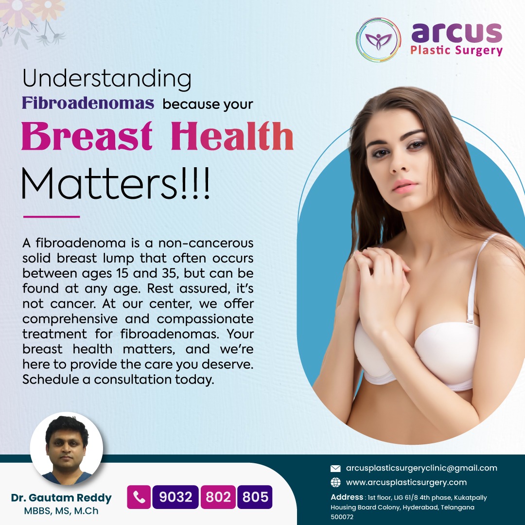 Understanding Fibroadenomas because your breast health matters!!!

#fibroadenoma #breastcancerawareness #breastissues #annualbreastcheck #checkyourbreasts #breastconcerns #breastcancer #breastspecialist #breasthealth #arcus