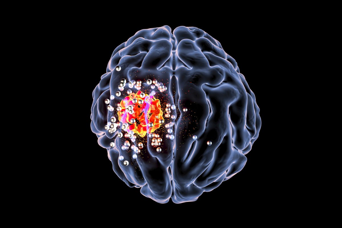 Nanoparticle Breaks through Blood-Brain Barrier to Target Brain Metastases. Learn how: ow.ly/lxi450RywCl
