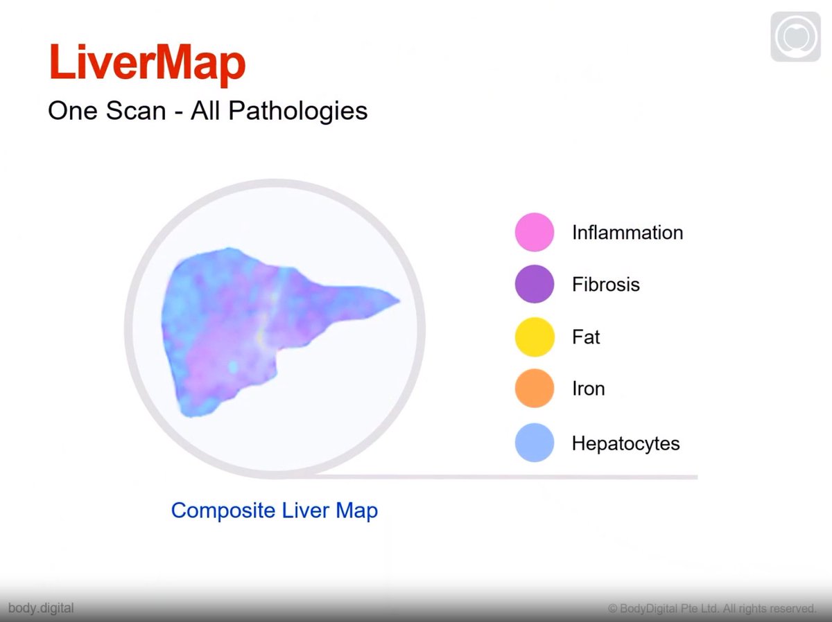 #LiverMap: one scan, all key #liver pathologies - #inflammation, #fibrosis, #fat, #iron - in under a 10-minute scan. #BodyDigital #ISMRM2024 #ISMRM