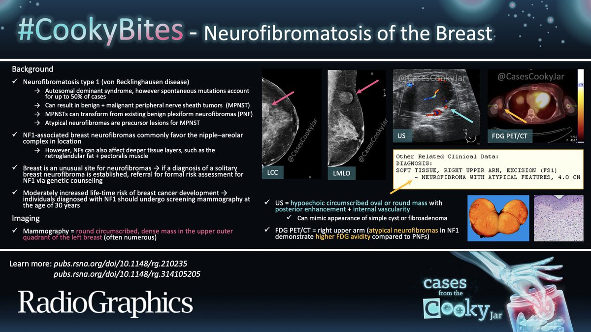Answer: Neurofibromatosis of the Breast Learn more: 🔗pubs.rsna.org/doi/10.1148/rg… 🔗pubs.rsna.org/doi/10.1148/rg… #CookyBites #162 #RGphx @cookyscan1 @RadioGraphics