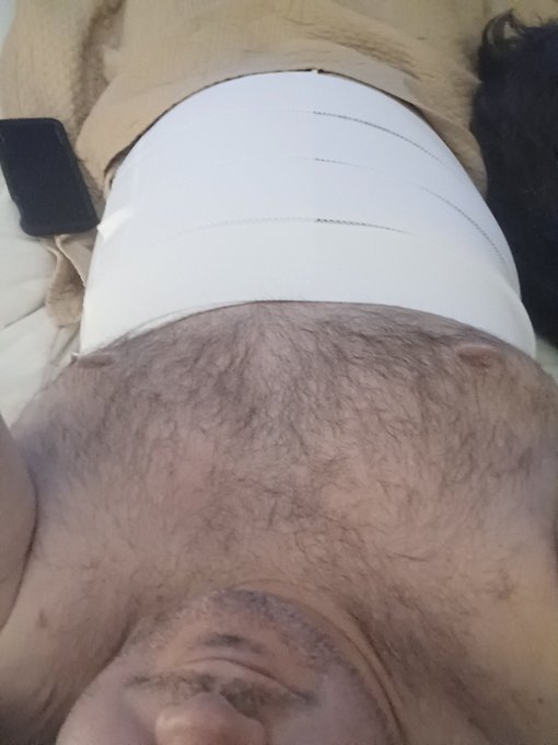 Spinal cord surgery was a success. In a lot of pain. 10 days on my back laying on 15 staples along my<a href="/tag/cumshot"class="tags"><span>#cumshot</span></a><a href="/tag/cum"class="tags"><span>#cum</span></a><a href="/tag/bigcock"class="tags"><span>#bigcock</span></a><a href="/tag/mtf"class="tags"><span>#mtf</span></a><a href="/tag/gaydaddy"class="tags"><span>#gaydaddy</span></a><a href="/tag/jockstrap"class="tags"><span>#jockstrap</span></a>