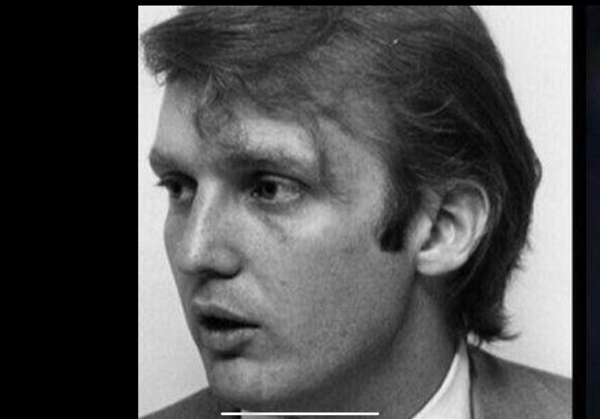 #PlasticSurgeon says Trump lost all his money on #cosmeticsurgery to look like #Elvis. A #Hollywood executive lied to him and told him he would let him play the King in a movie, but secretly told everyone 
 that #TrumpSmellsLikeAss!

#Memphis #Music #LosAngeles #DC #NYC #Miami